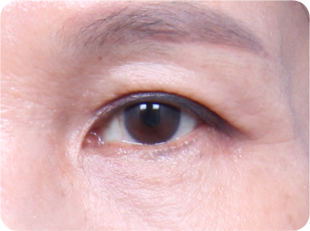 STEP 04
