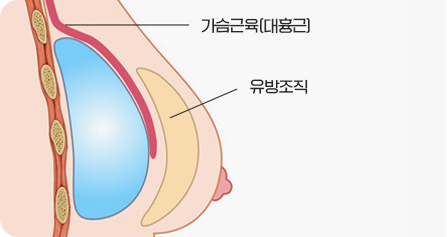 3D 이중평면법