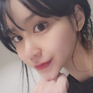 스케치성형외과 리얼 셀카 2