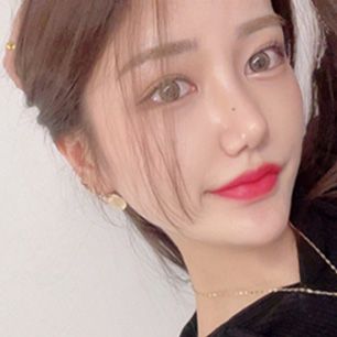 스케치성형외과 리얼 셀카 1